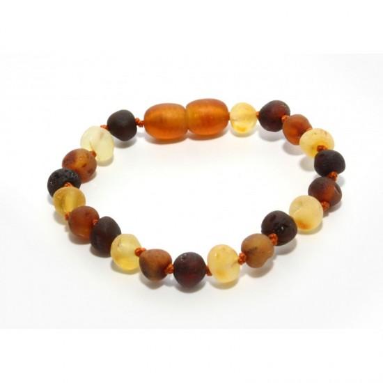 Baltic Amber Baby Teething Bracelet/Anklet - Genuine & Authentic, 13-16cm,  in Dark Honey (Cognac) - Amber People